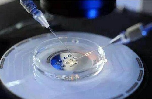 第二代试管婴儿的费用大概是多少？贵不贵？