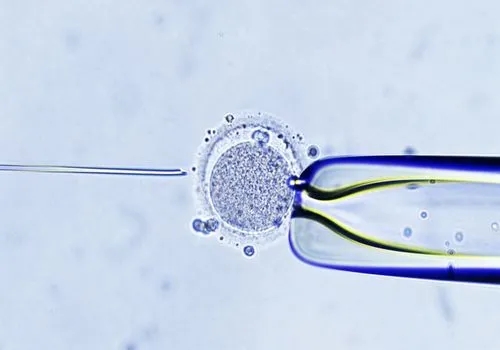 试管婴儿技术之精子洗涤技术是怎么实现的？
