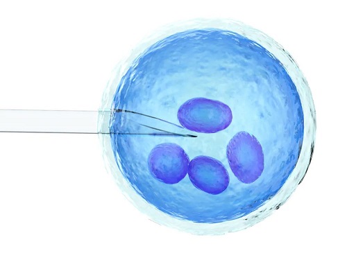 第二代试管婴儿对精子的要求是什么？