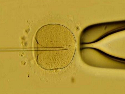 第三代试管婴儿如何避免遗传？多囊肾病对生育有影响吗？